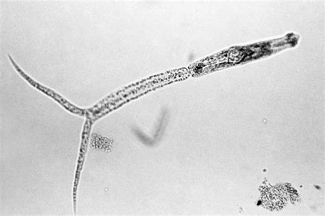  Xenosporidium! 你有聽說過這種奇妙的「寄生小精靈」嗎？