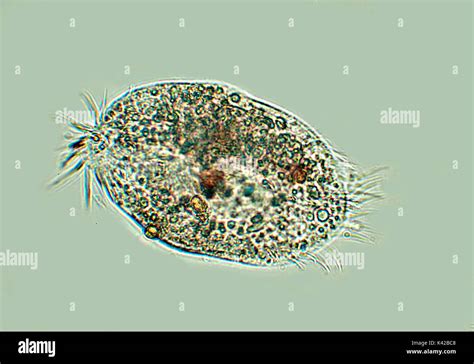  Rhabdostylis，An Intriguing Ciliate With Striking Hair-like Structures and Exquisite Swimming Capabilities!