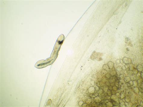   Yorkshire Trematode：This Curious Flatworm Can Cause Unexpected Mayhem In Its Tiny Hosts!